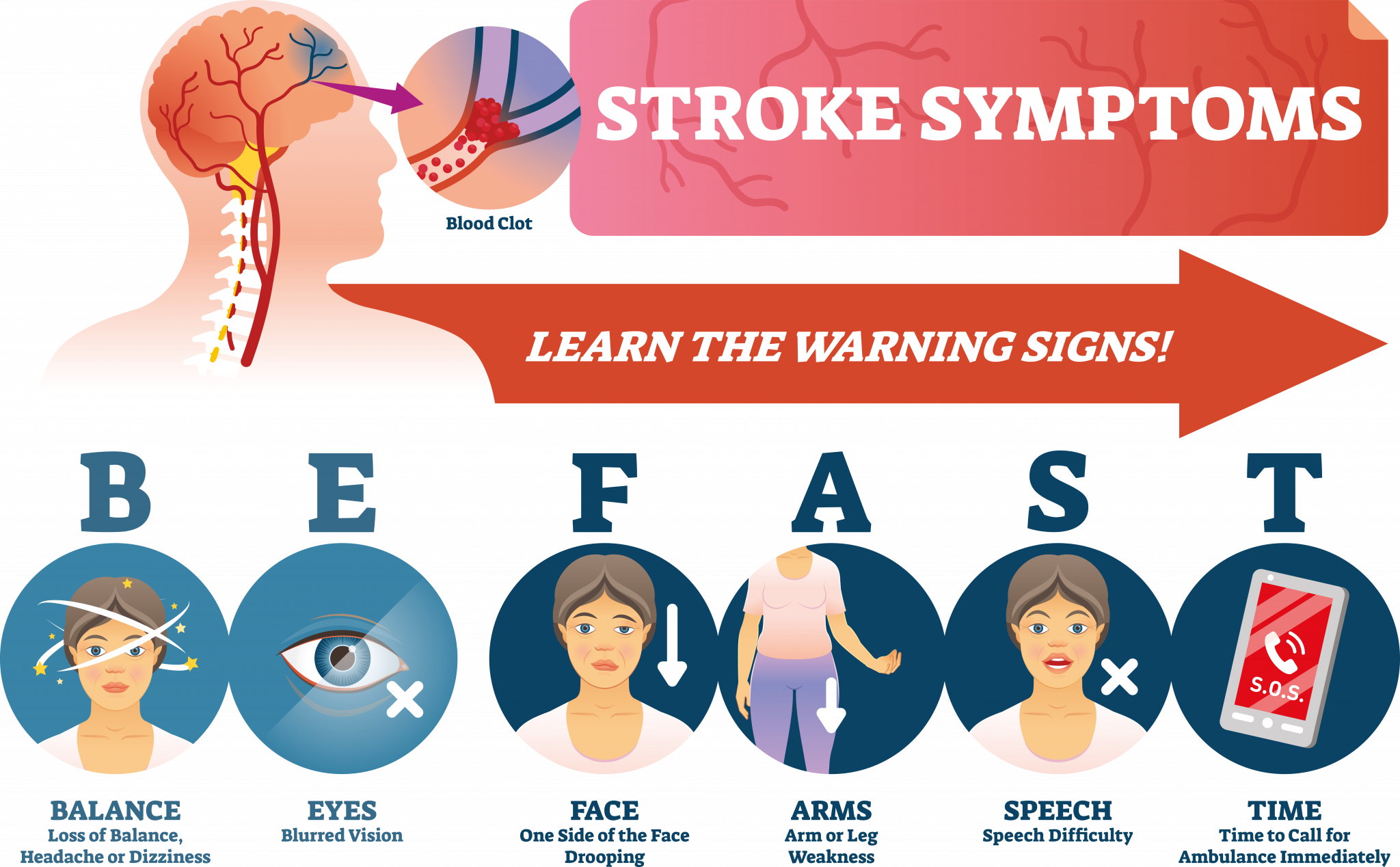 Stroke us. Инсульт. Stroke Symptoms. Инсульт картинки. Тест на инсульт.